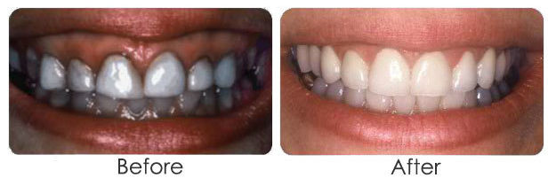 periodontal plastic surgery nyc