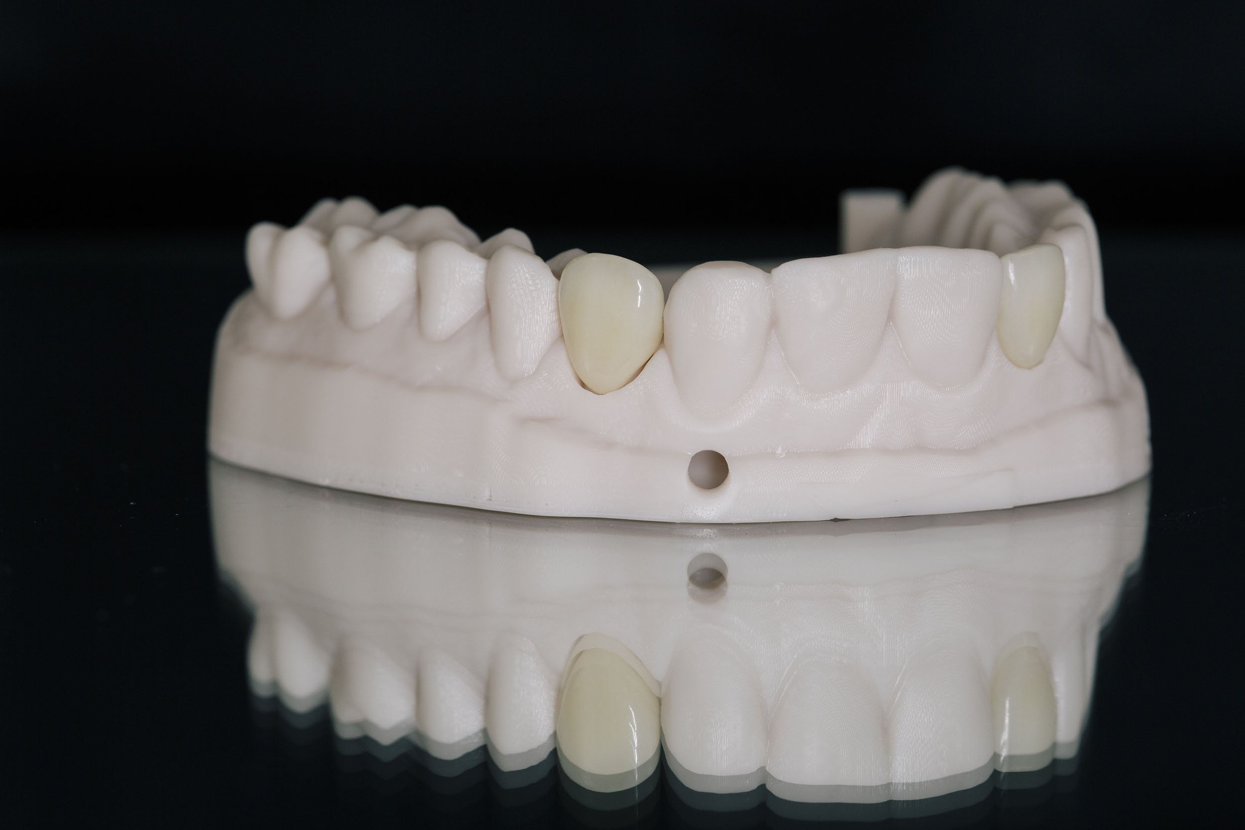 Teeth | Ismile 