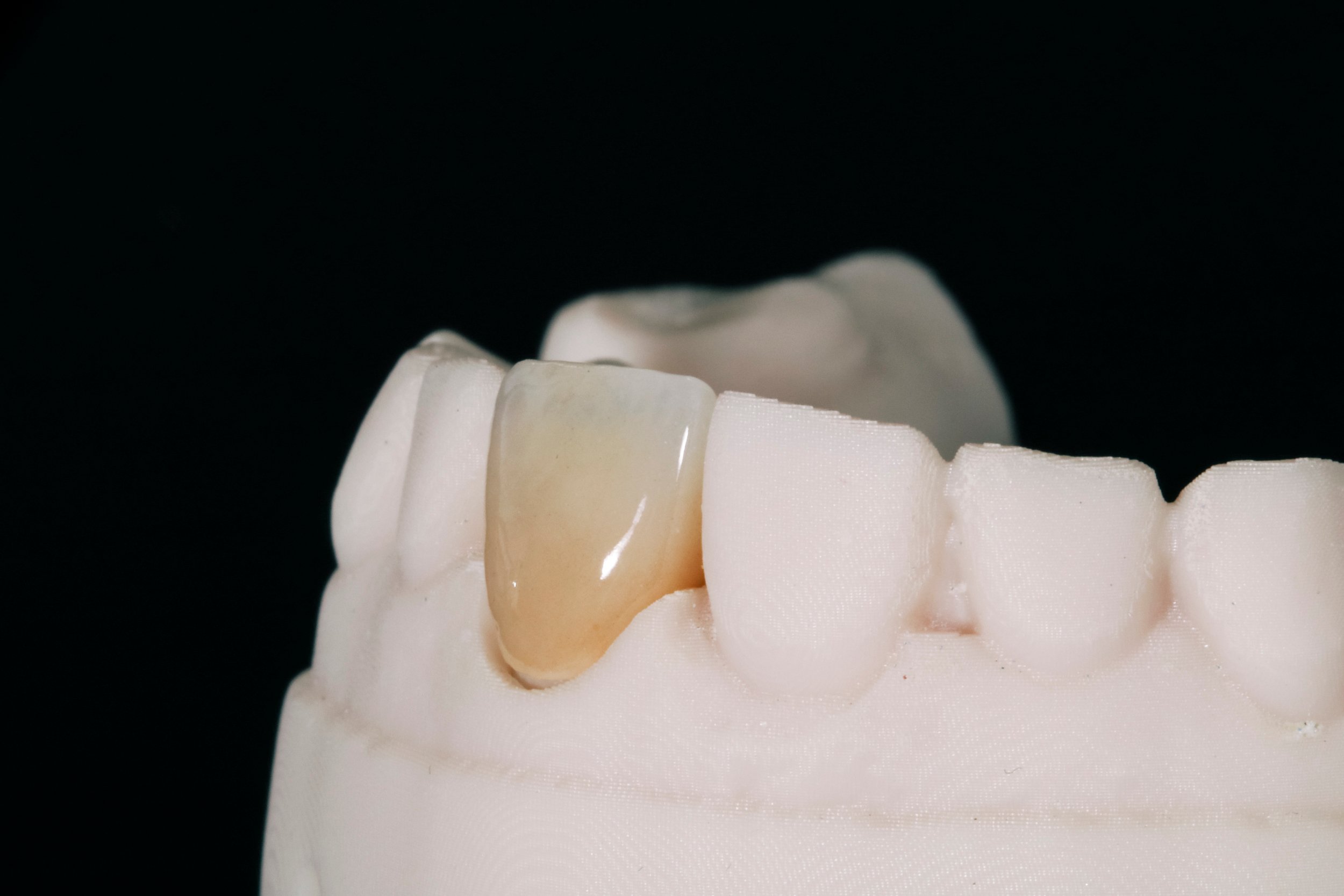Teeth Problems | Ismile