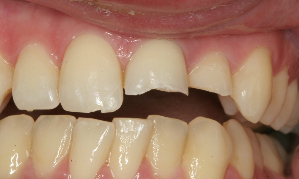 Case 10 Pre Op