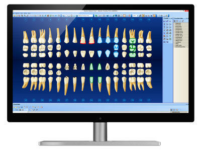 Dentrix®-Electronic-Medical-Records-EMR_27ed9b35a39cfa75c0eba12ef9736eea