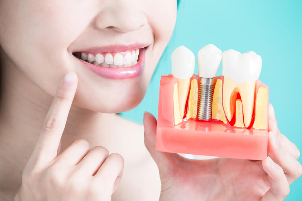 New Dental Technology for Missing Teeth  