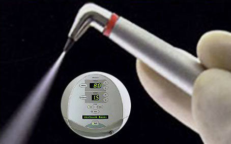 air-abrasion_27ed9b35a39cfa75c0eba12ef9736eea