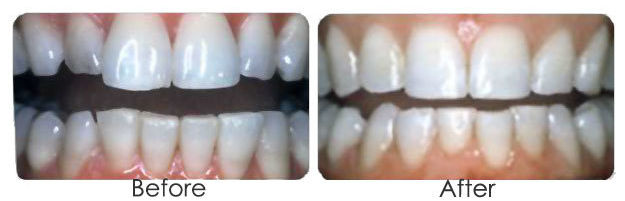 contouring_63e041deab50e07a19f780f3fe3f556b