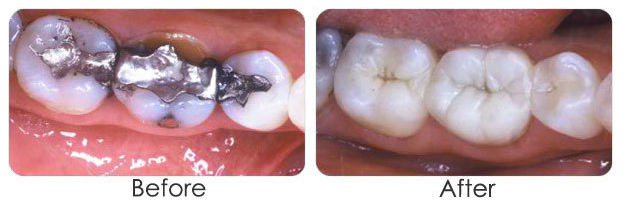 restorations_63e041deab50e07a19f780f3fe3f556b
