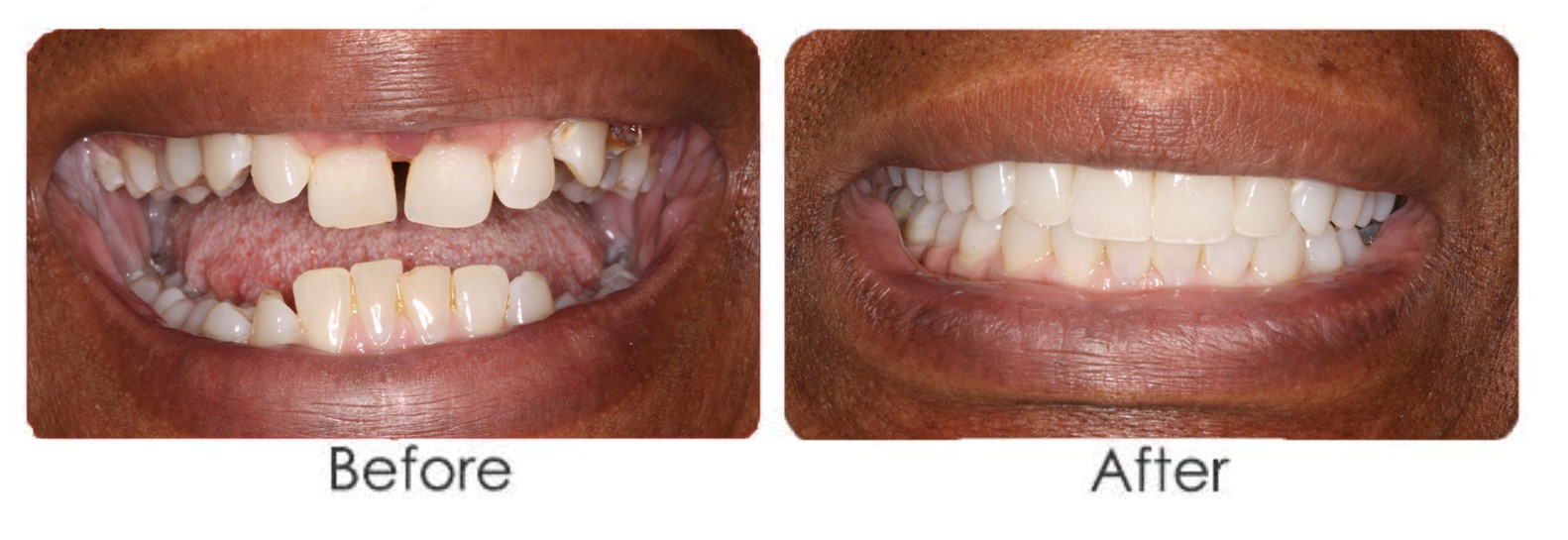 ortho