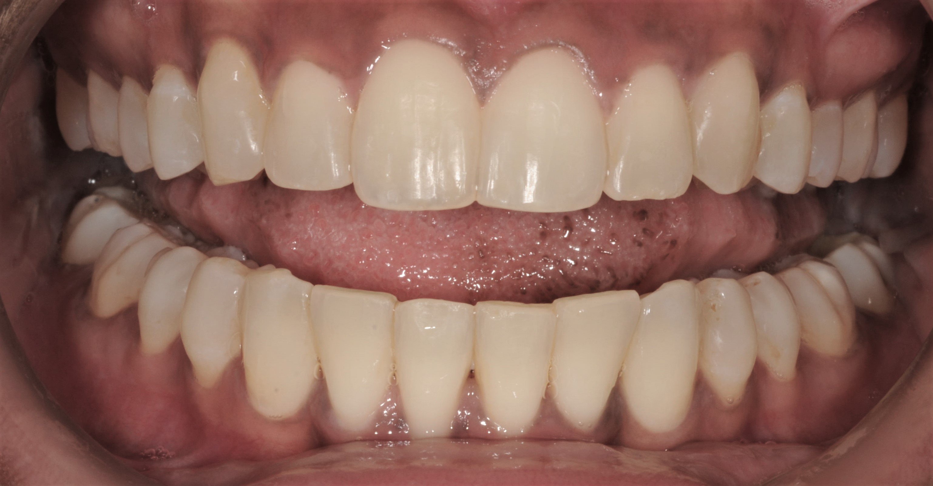 post op teeth (1) (1)