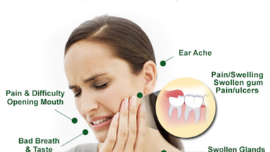 Wisdom Teeth Symptoms Sign Pain