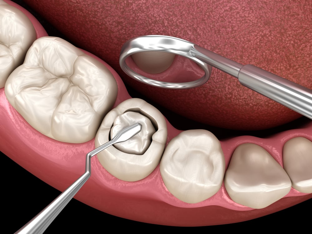 Periodontal plastic surgery