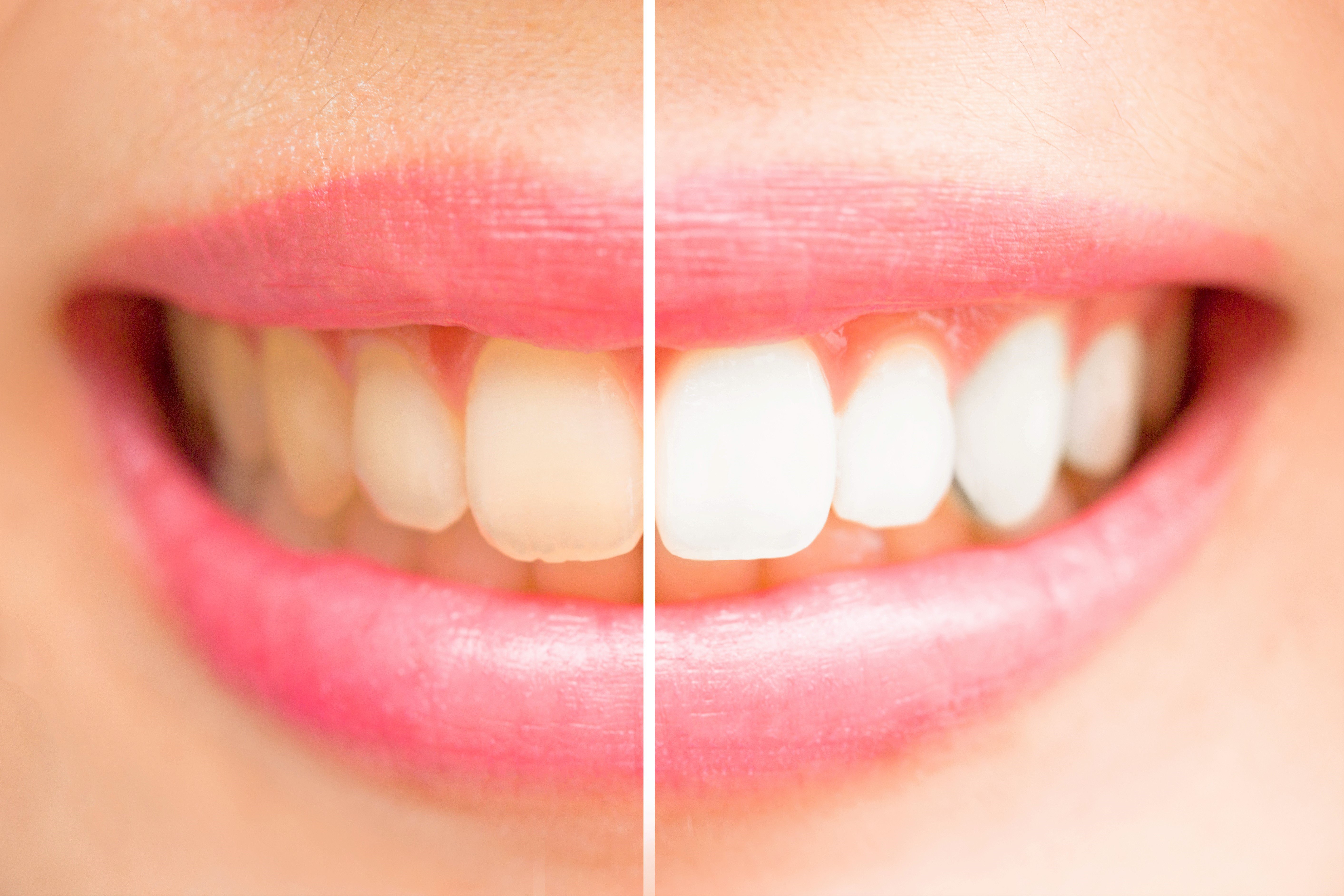 whitening half