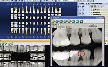xray_27ed9b35a39cfa75c0eba12ef9736eea