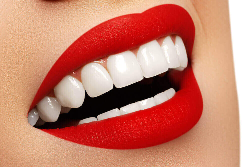 Teeth Whitening at home